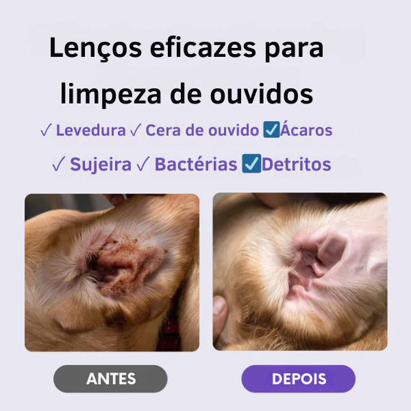 Ear Cleaning Wipes